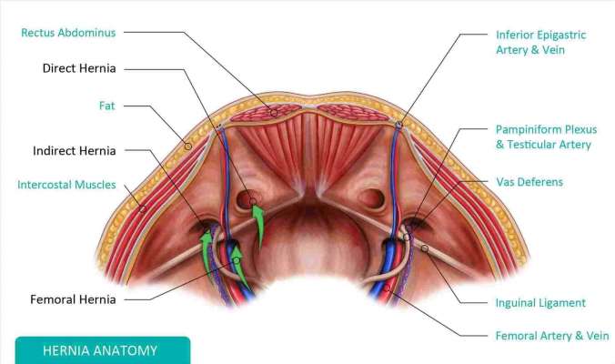 hernia anatomy